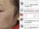 教育局回应班主任殴打多名学生:代课的 已被辞退