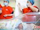 罹患复杂危重先心病的“袖珍宝宝”上海康复出院 心脏比鸽蛋还小