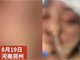 女子未给丈夫一万块钱充手游 被殴打致失明